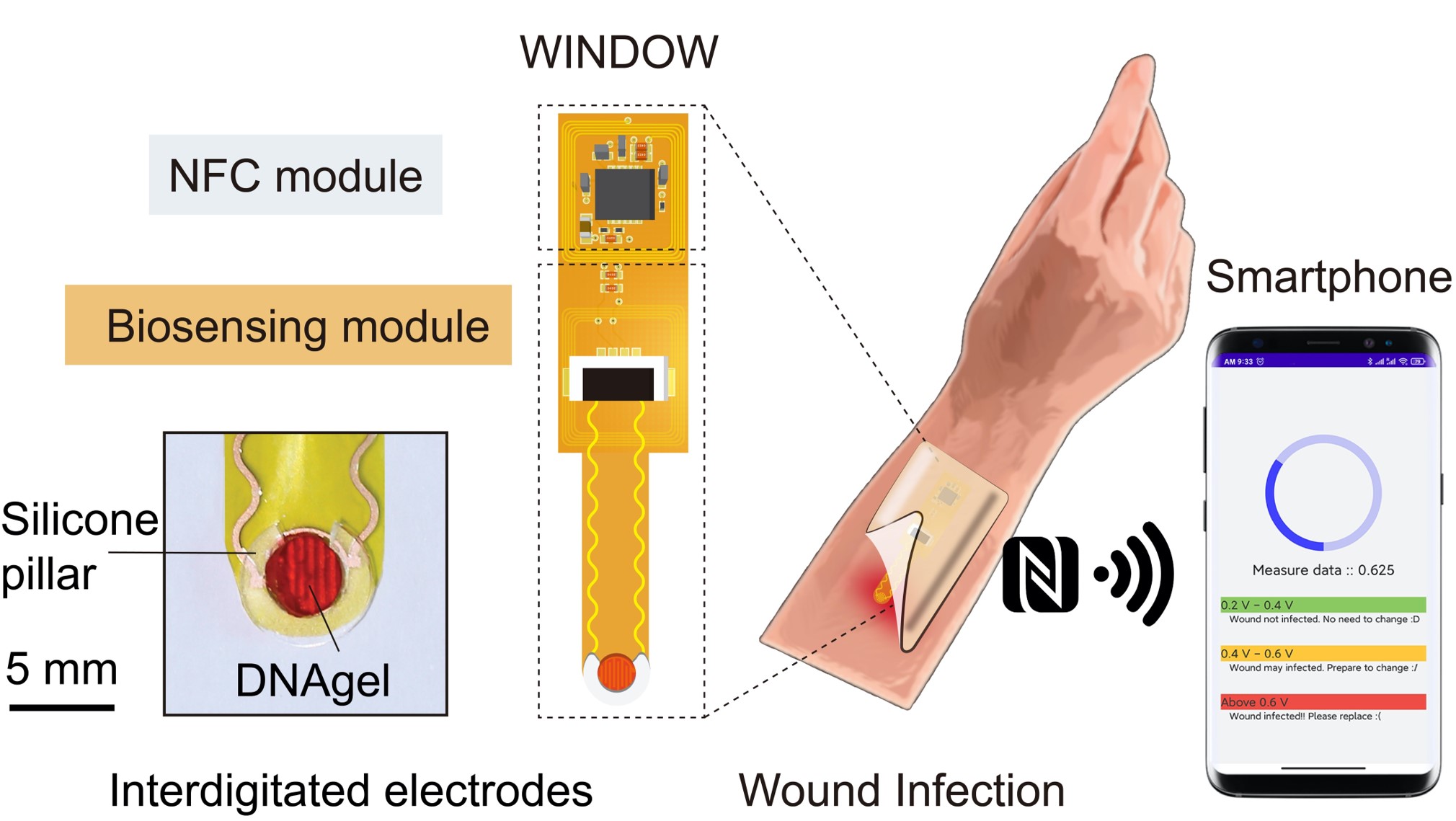 The wound monitoring device consists of three components: a biocompatible DNA hydrogel, a biosensing module and a smartphone-compatible communication module. The device monitors biological changes in the wound and wirelessly transmits these signals to a smartphone for interpretation